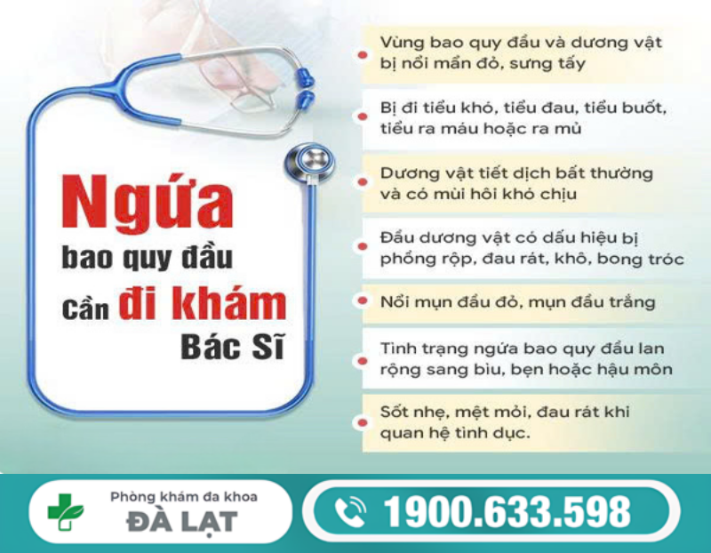 Hình ảnh minh họa